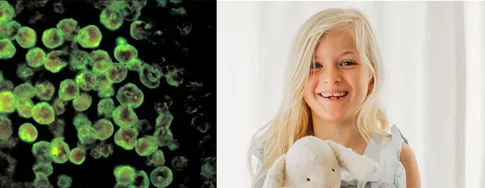 Child dies from brain-eating amoeba infection